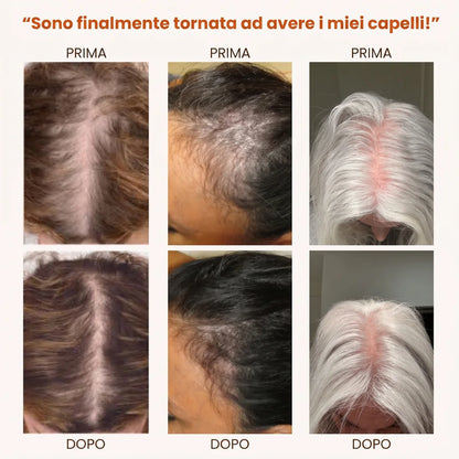 Bionelis® — Integratore Olio di Semi di Zucca + Saw Palmetto